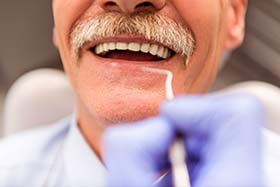 Dental Insurance - Elder Person getting dental work done